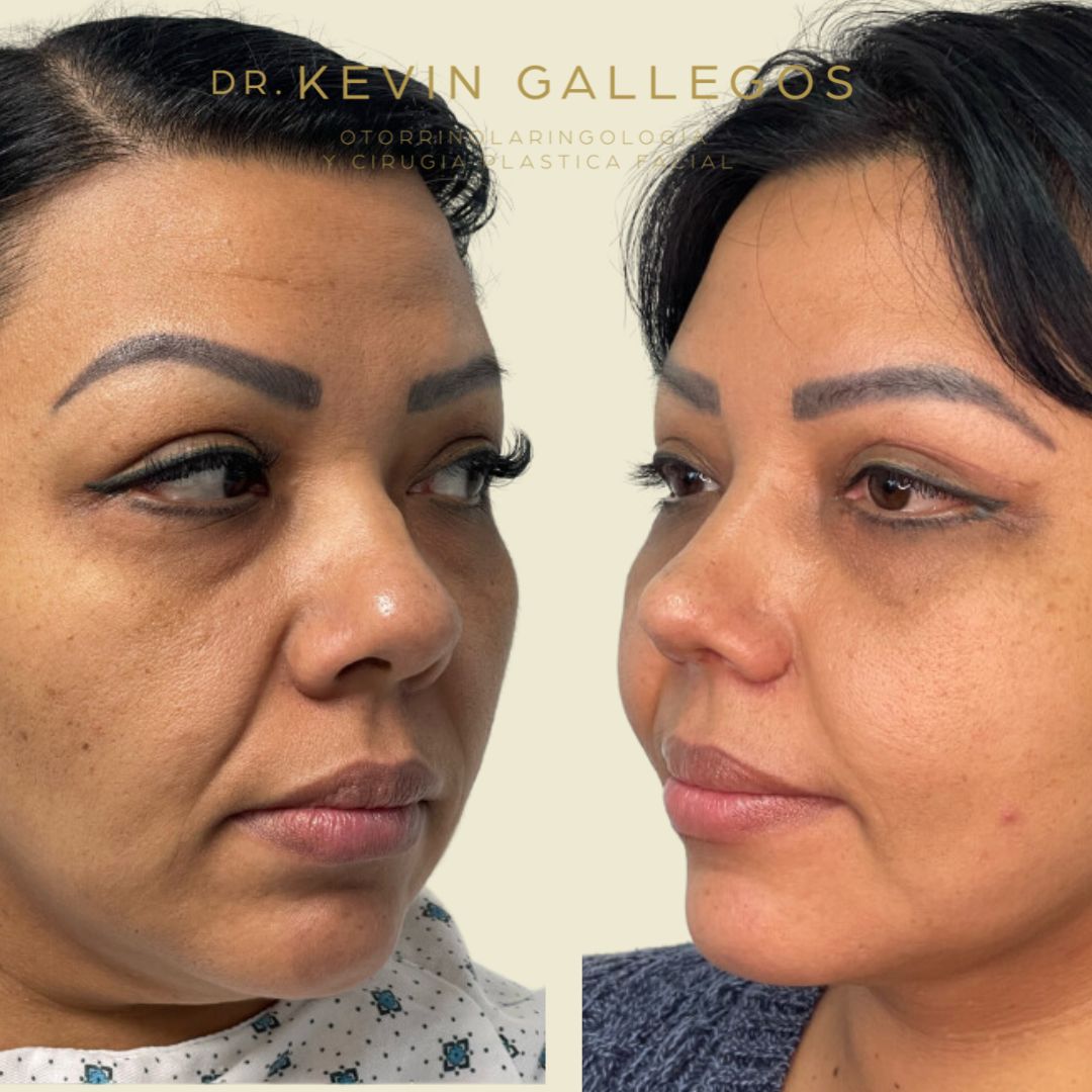 Kevin Iram Gallegos Montero-1