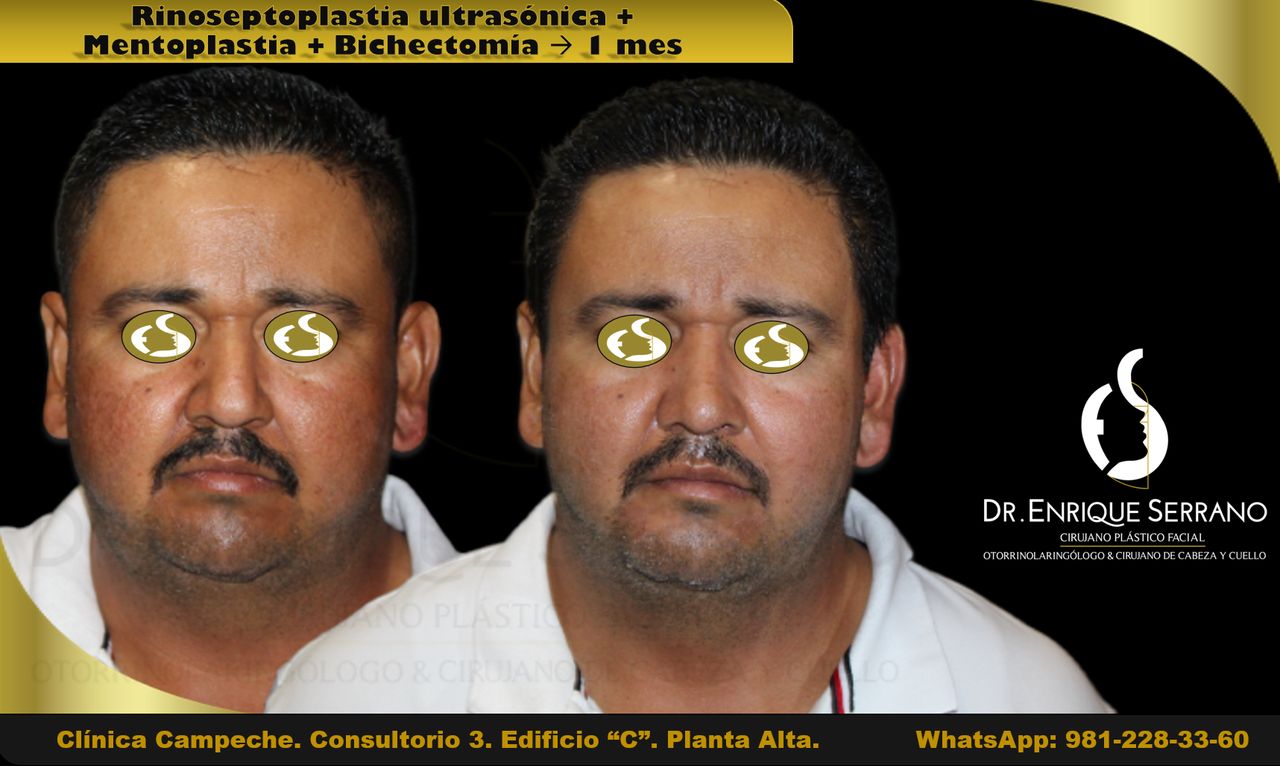 Enrique Serrano Cruz-24