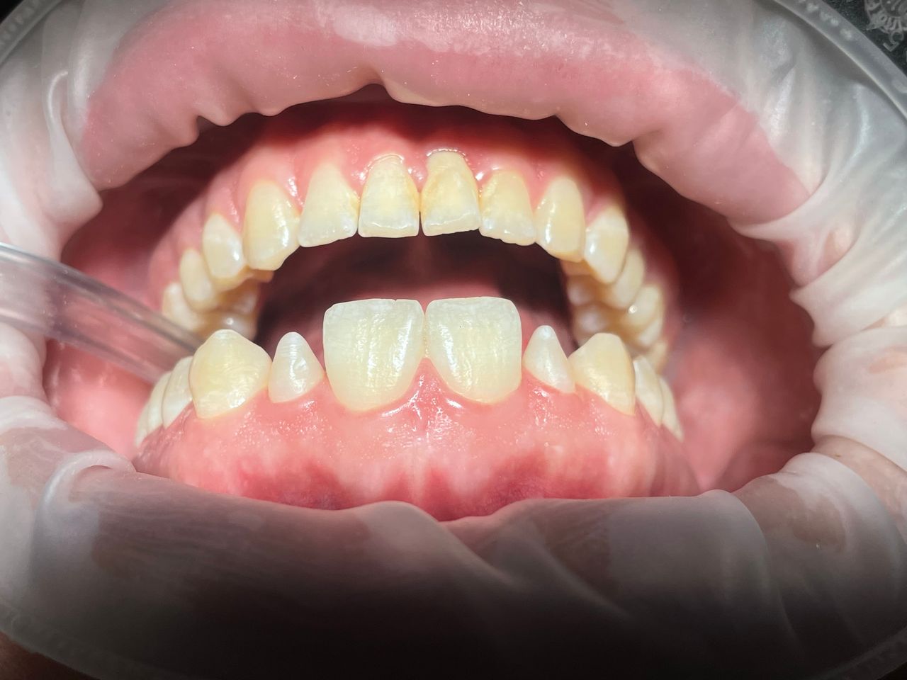 Valeria Muñoz Balboa-15