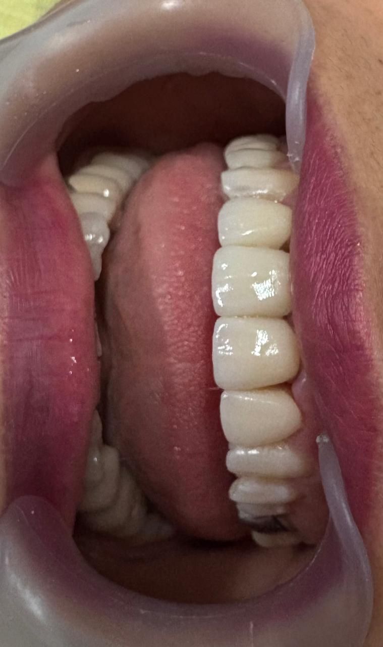 Arturo Romero Grande-29