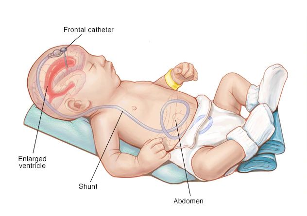 Roberto Gomez Raygoza-14