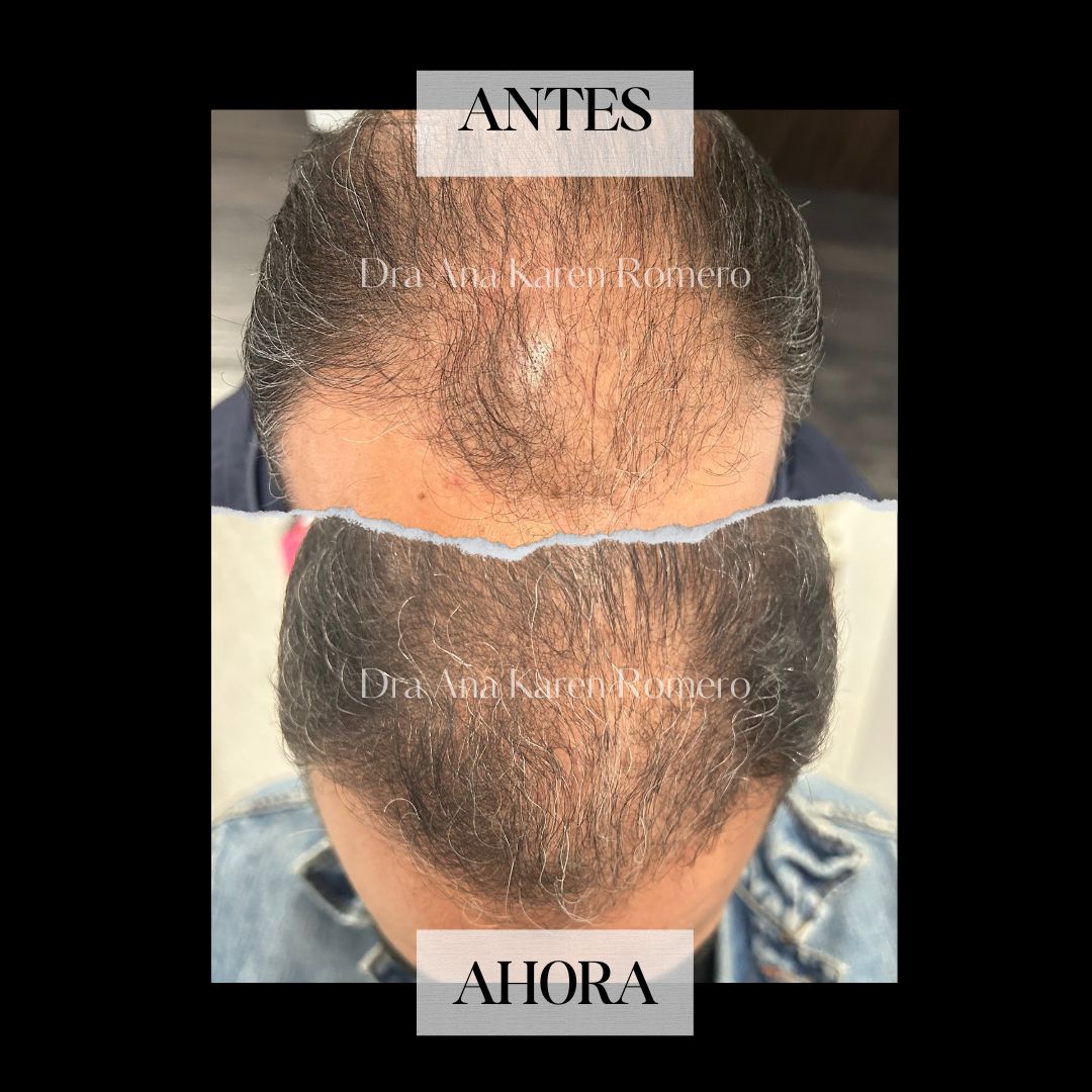 Ana Karen Romero Guzmán-3