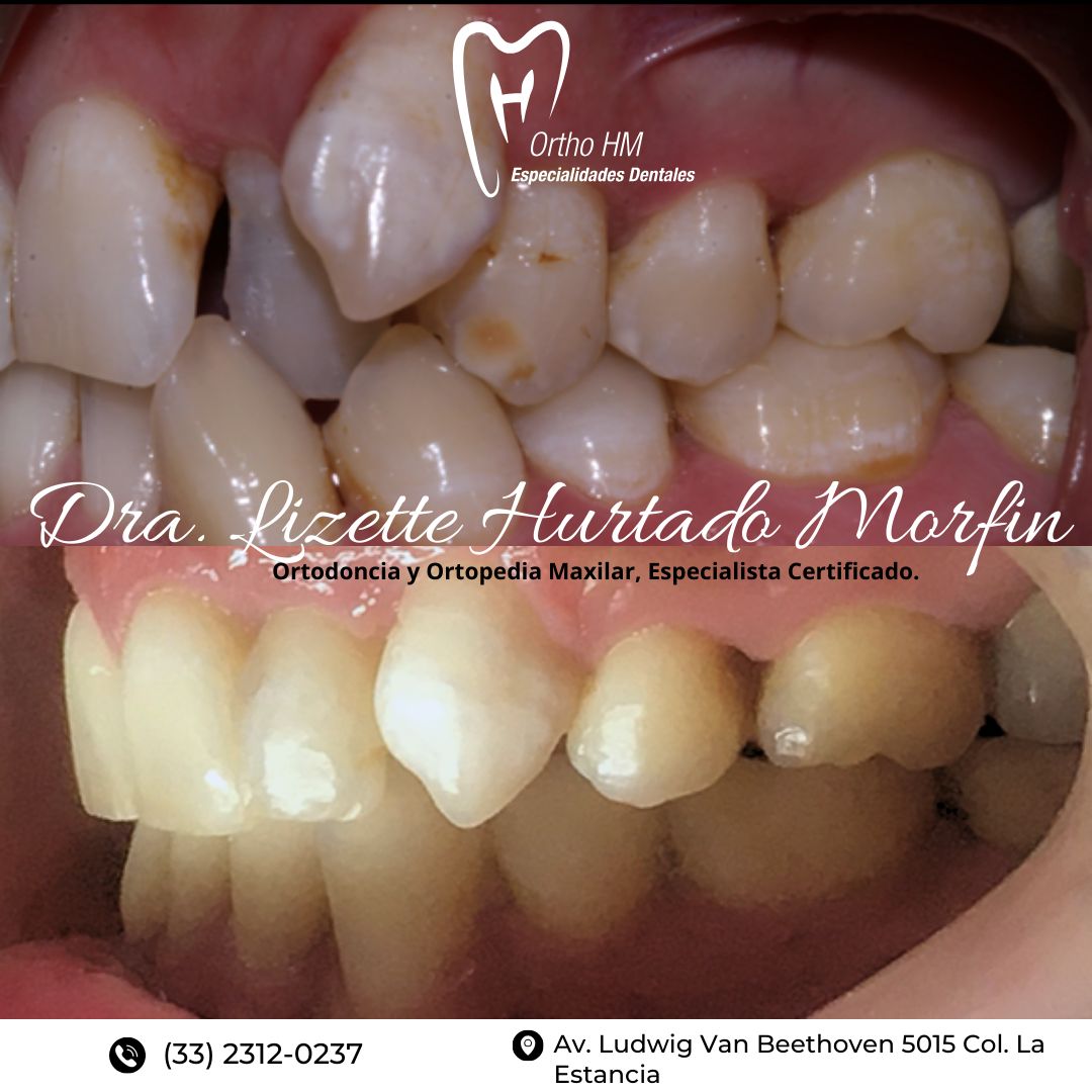 Lizette S. Hurtado Morfin-6