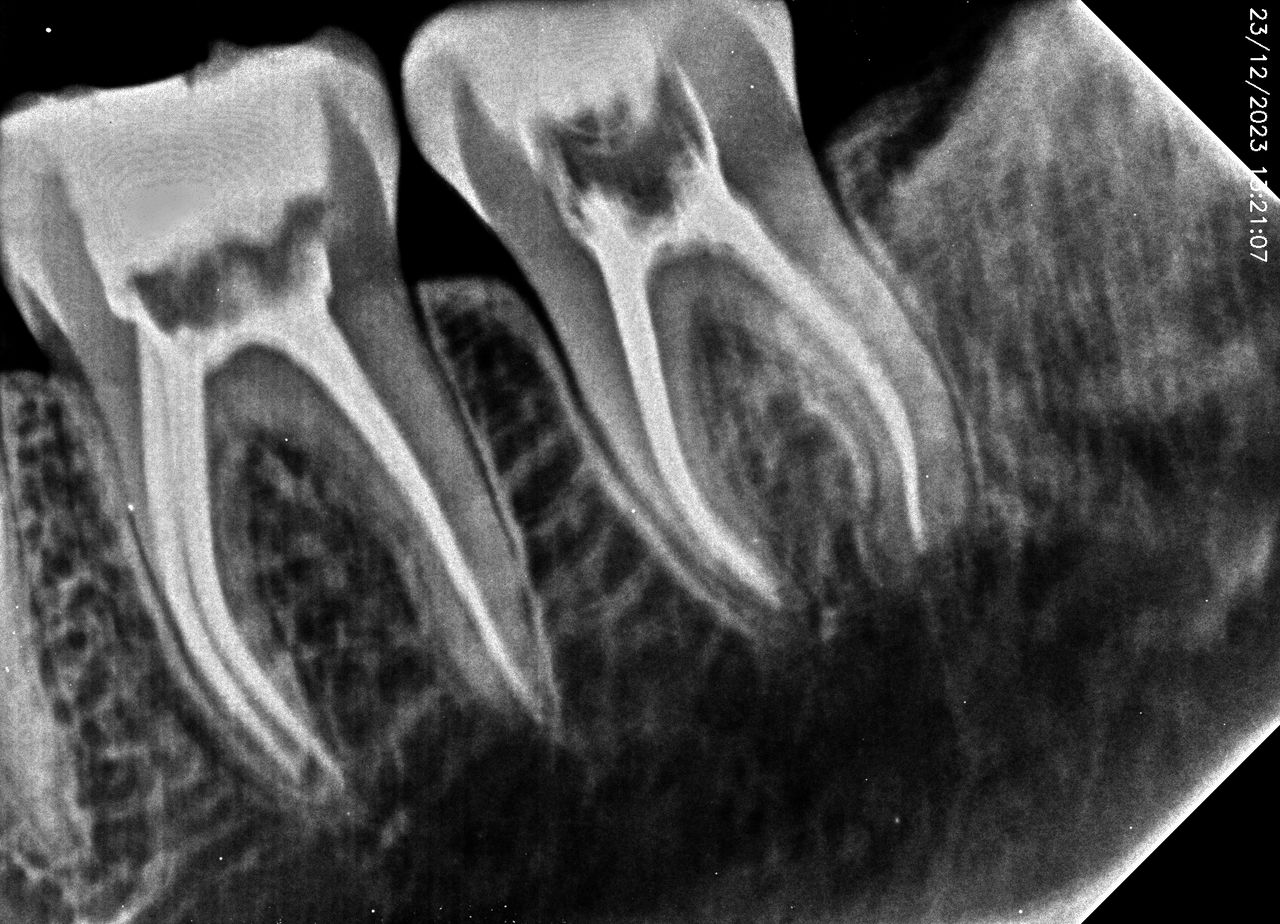 Juan Angel Cruz Rodríguez-17