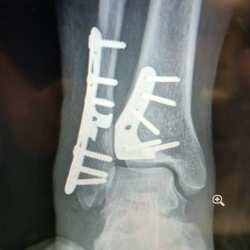 Jorge Yair Álvarez Ojeda-6