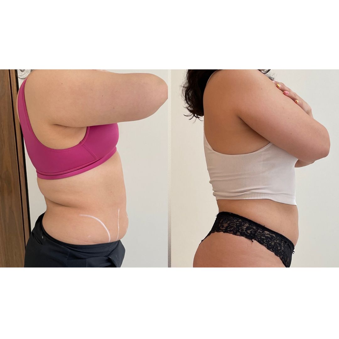 Alejandra Gutierrez García-32