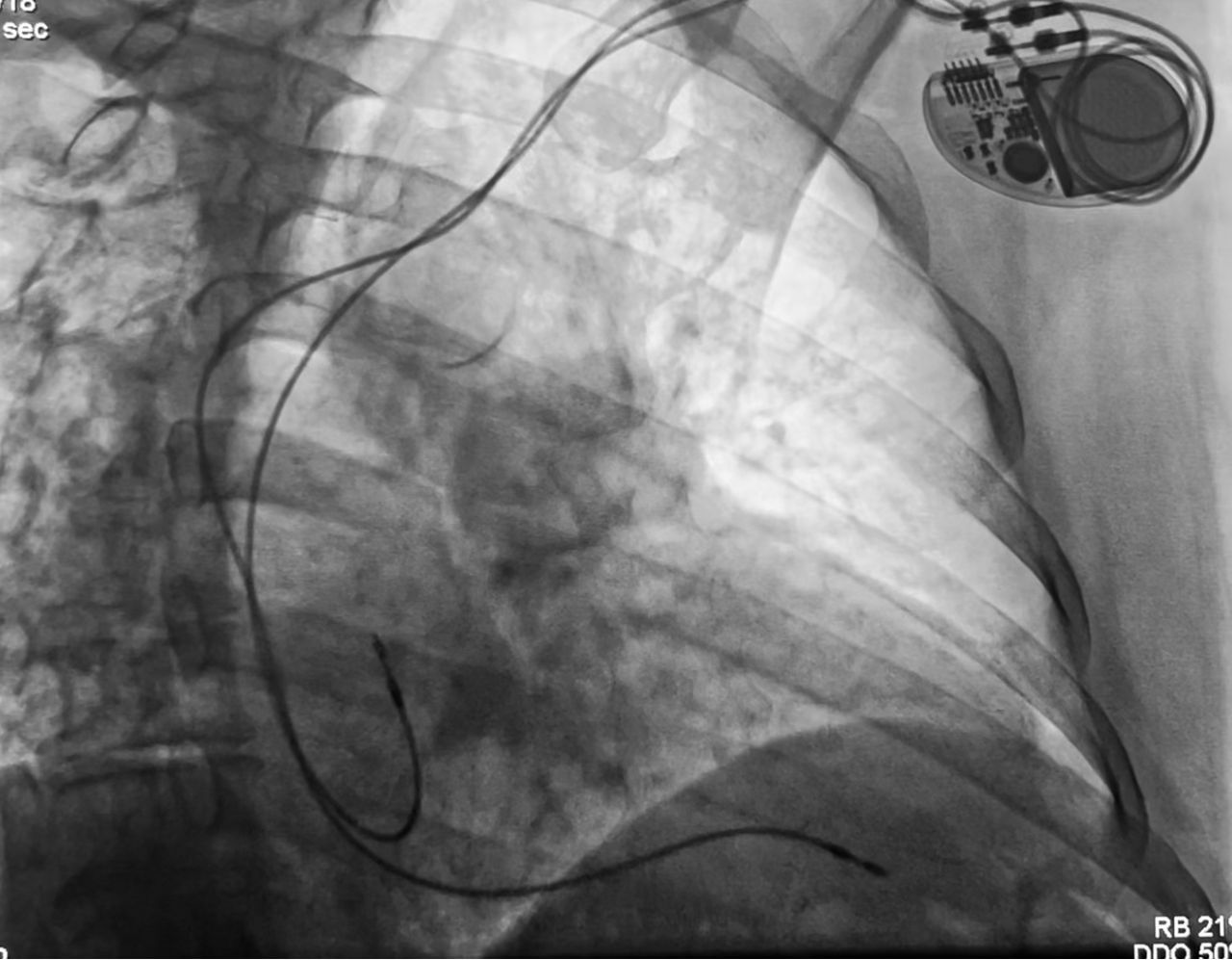 Abdón Ávila Chávez-18