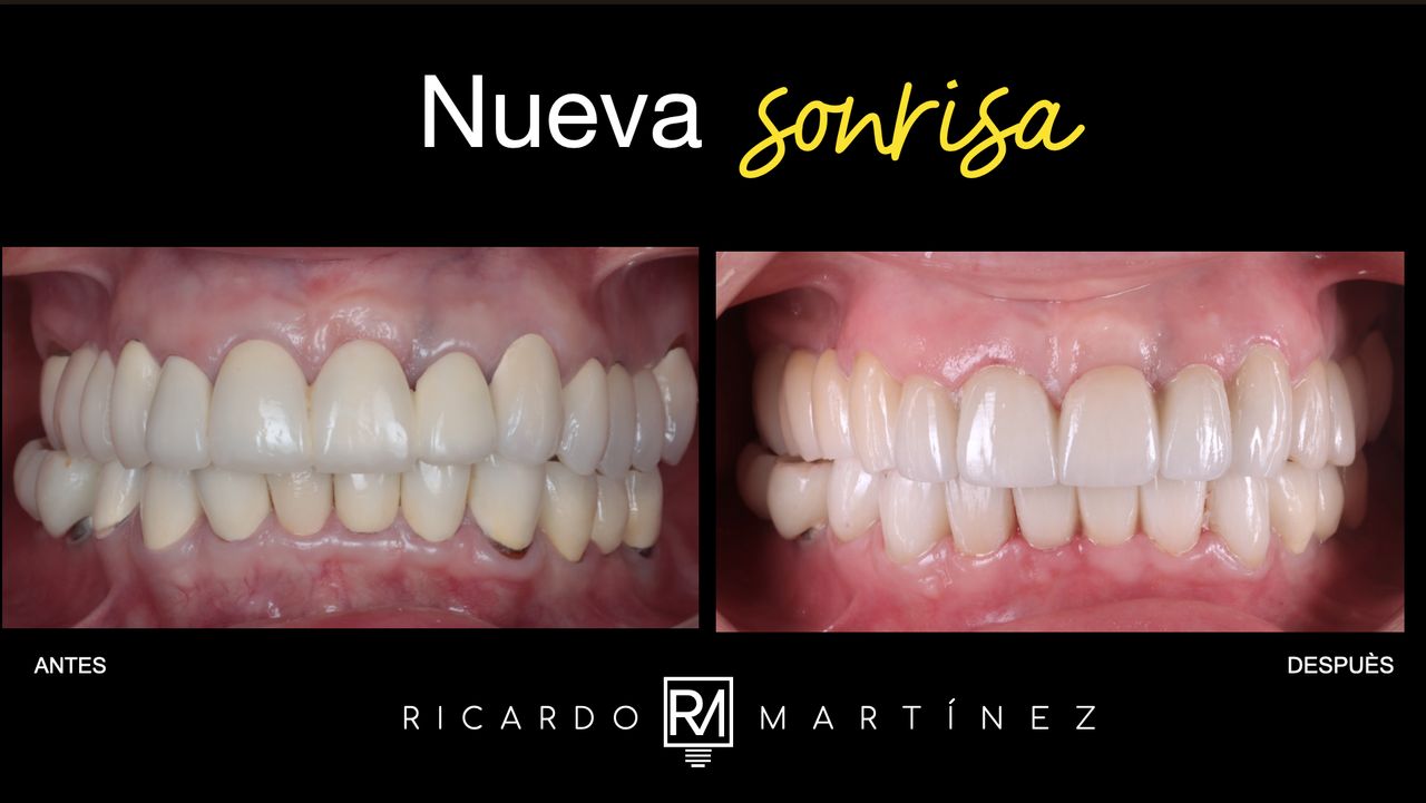 J. Ricardo Martínez-11