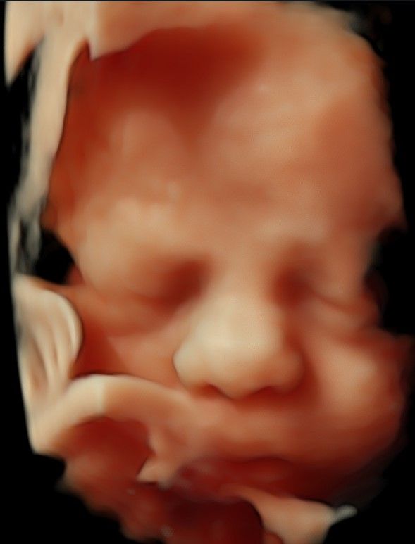 Nallely Moreno  Uribe-10