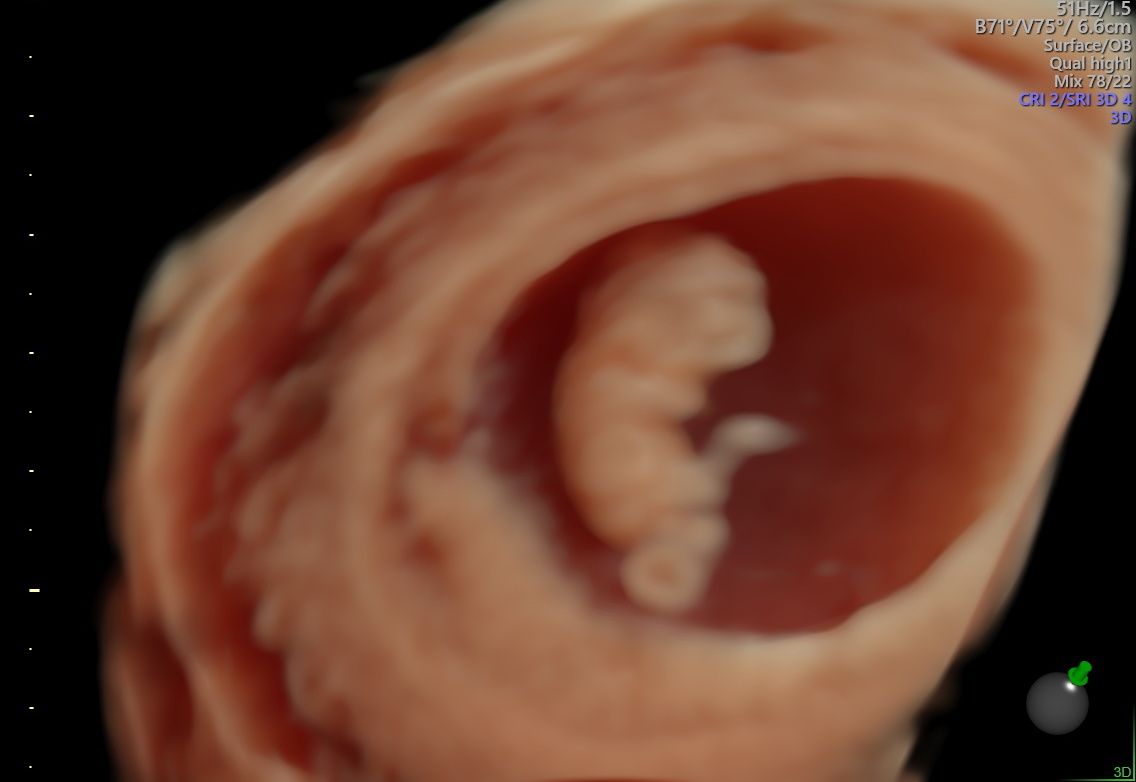 Alberto Bañuelos Peña-6