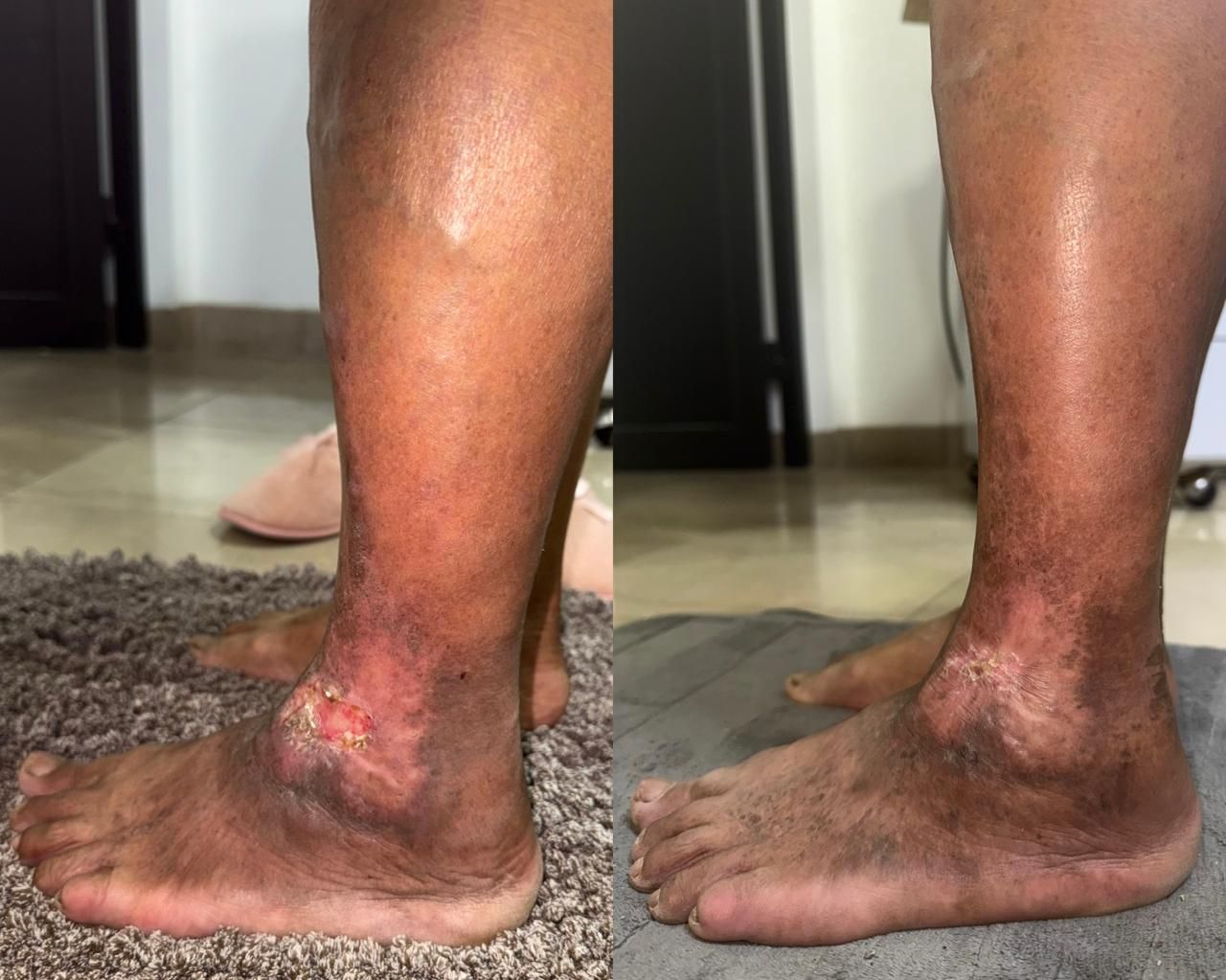 Jhonatan López González-75