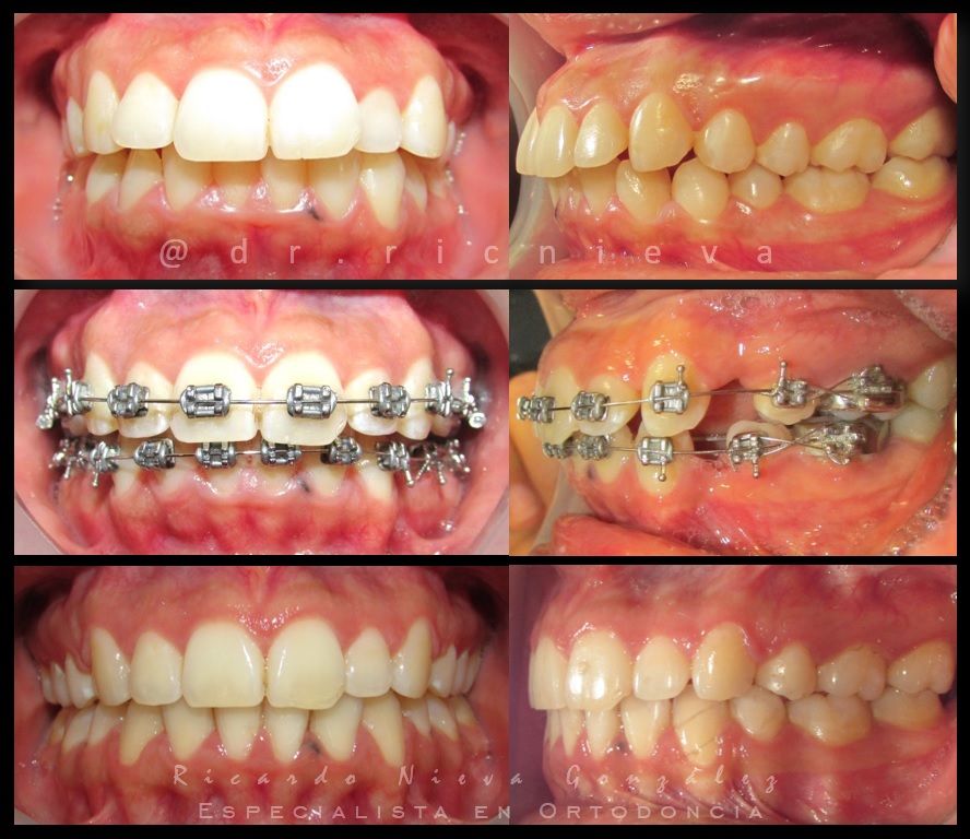 Ricardo Nieva González-4