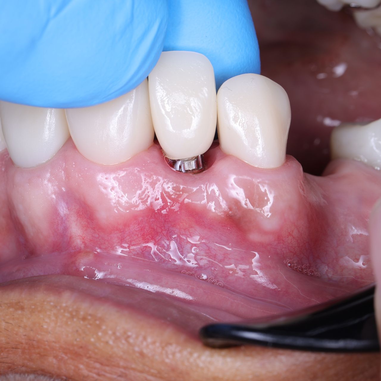 Marco Antonio Rodríguez-11