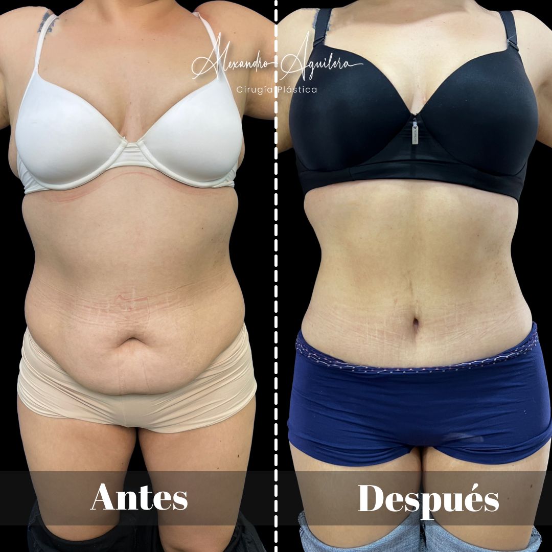 Alexandro Aguilera Salgado-10