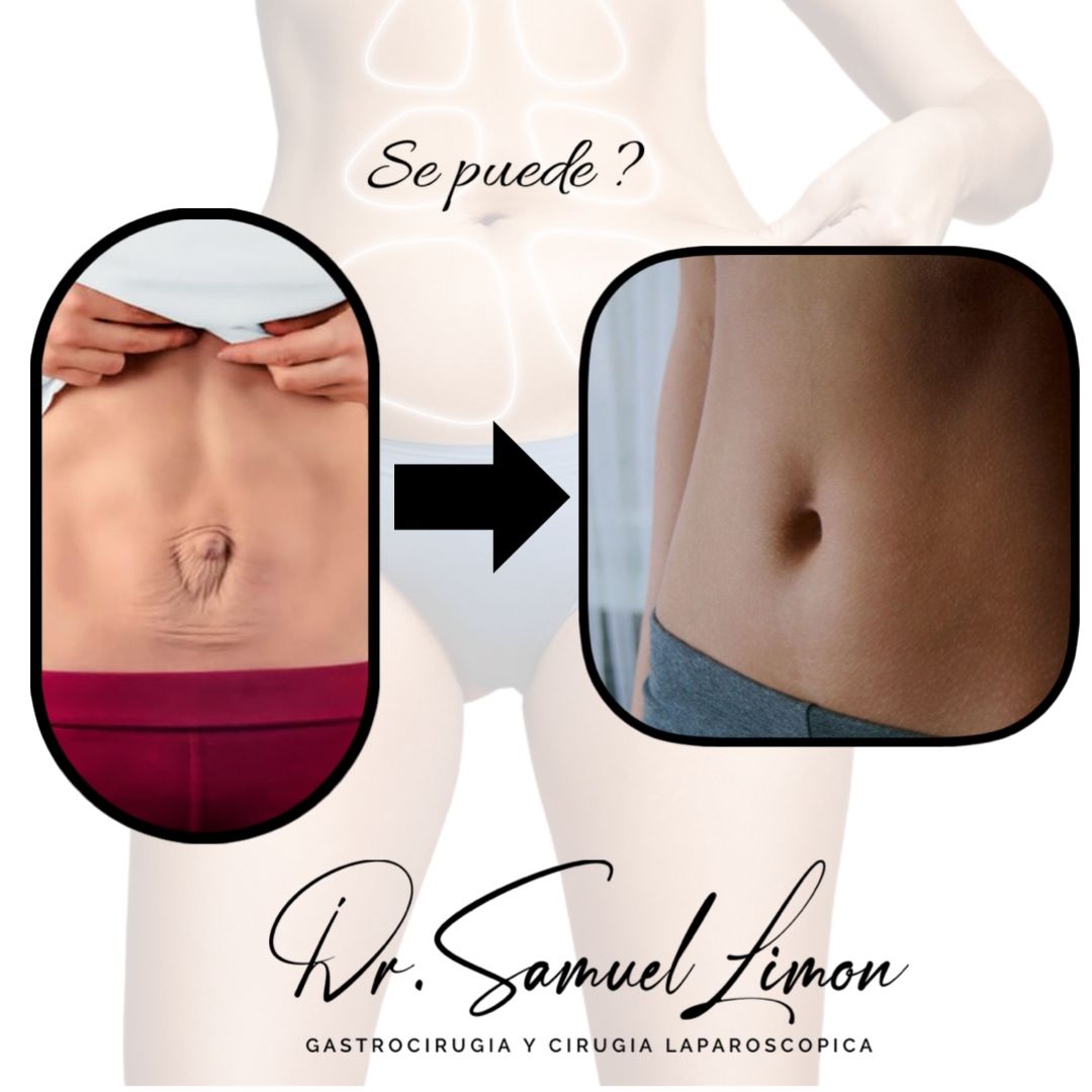 Samuel Limón Suarez-3