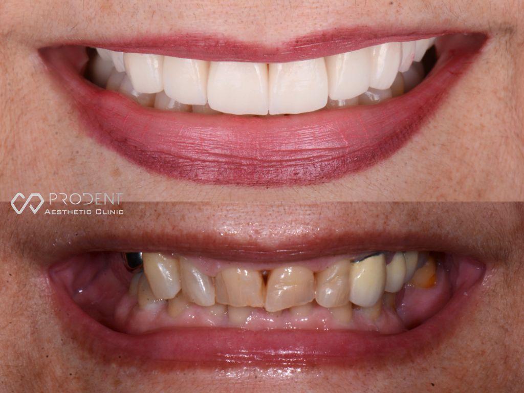 Ramiro Ivan Pérez Murillo-29