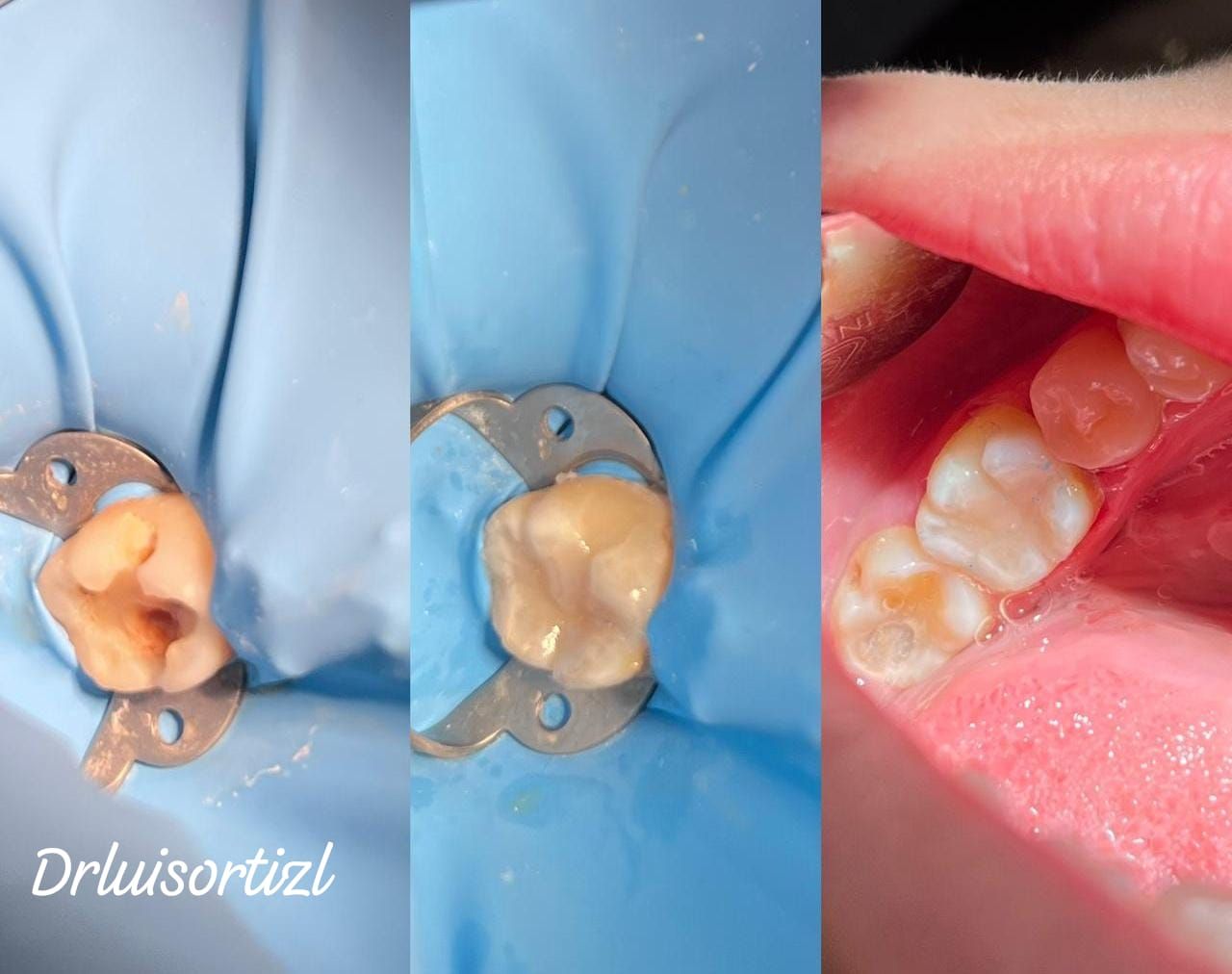 Luis Ángel Ortiz López-25