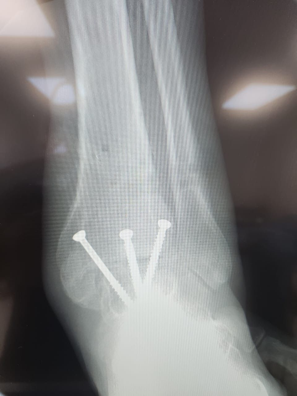 Emmanuel Benitez Biebrich-3