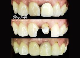 Nayeli Garcia Morales-32