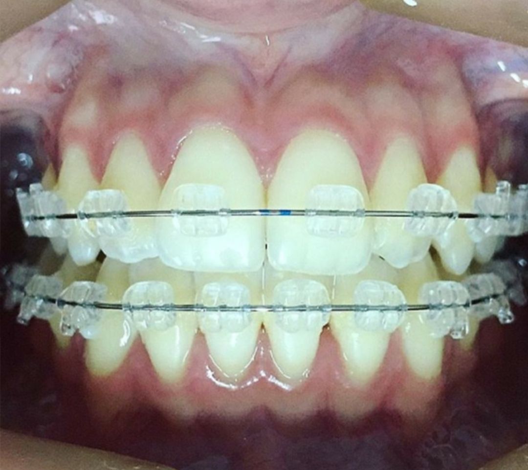 Gloria Haydee Castillo Castellanos-4