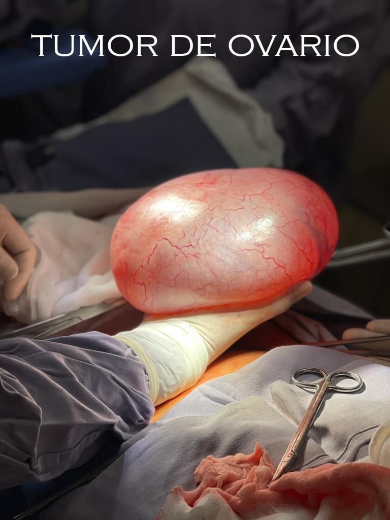 Moises Juda Ramos Abarca-14