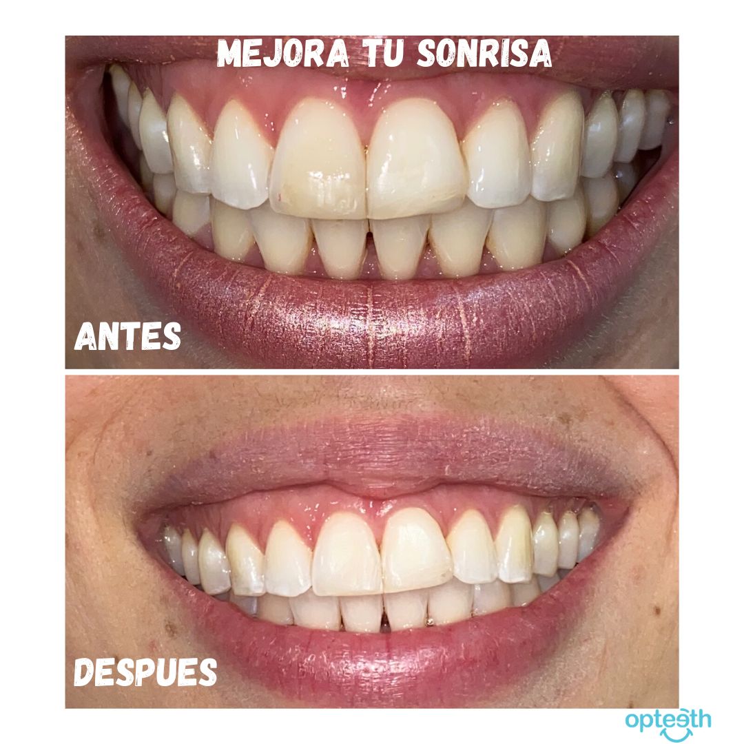 Zuriel Ayala Garcia-11