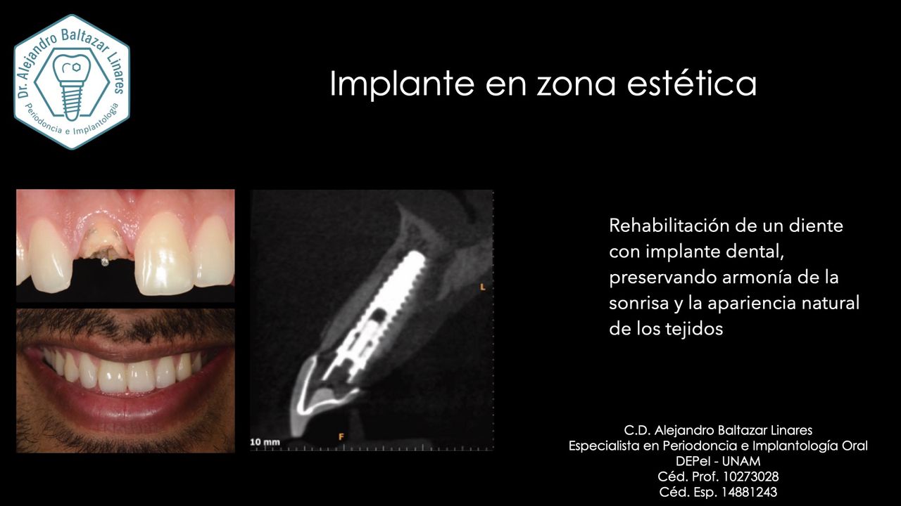 Alejandro Baltazar Linares-3