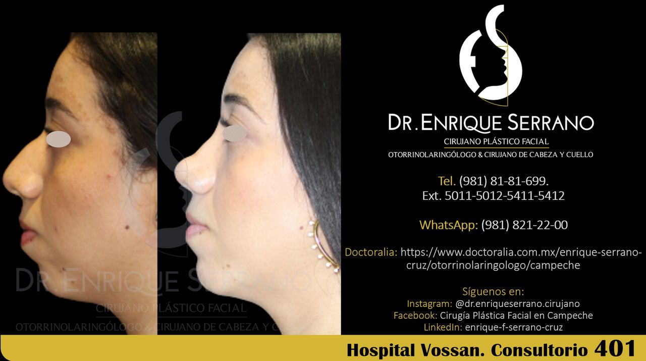 Enrique Serrano Cruz-117