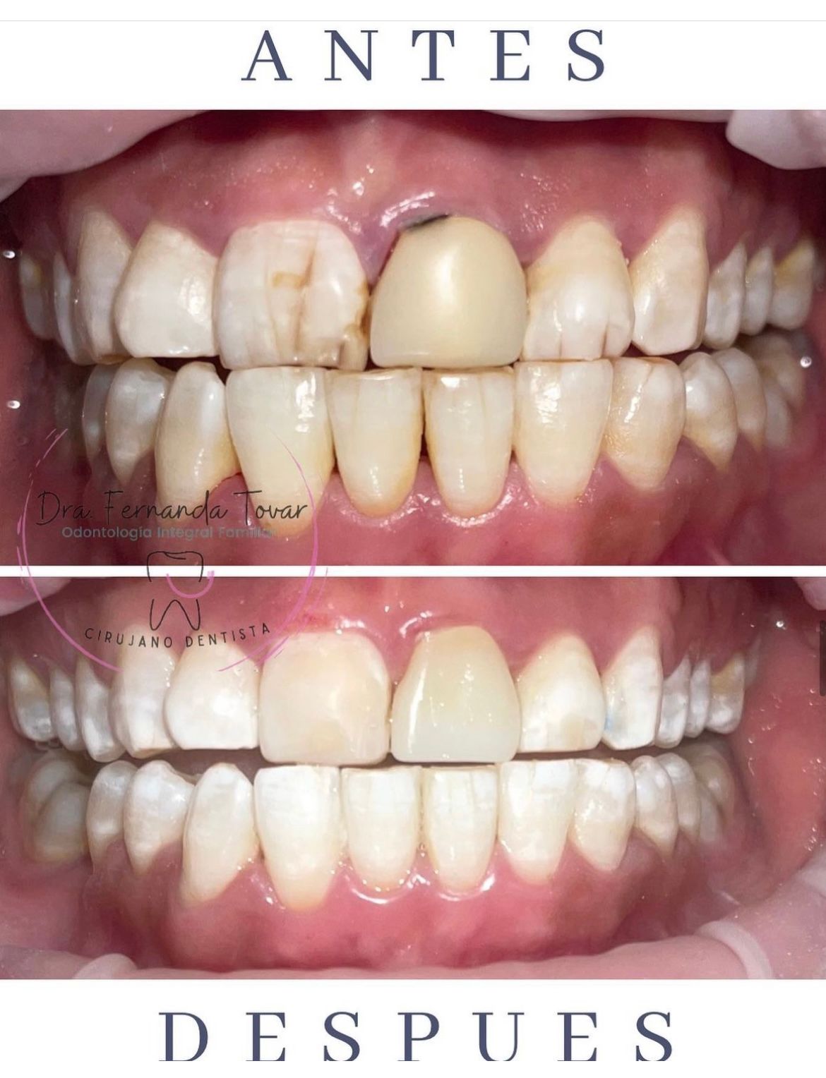 Fernanda Tovar Navarro-13