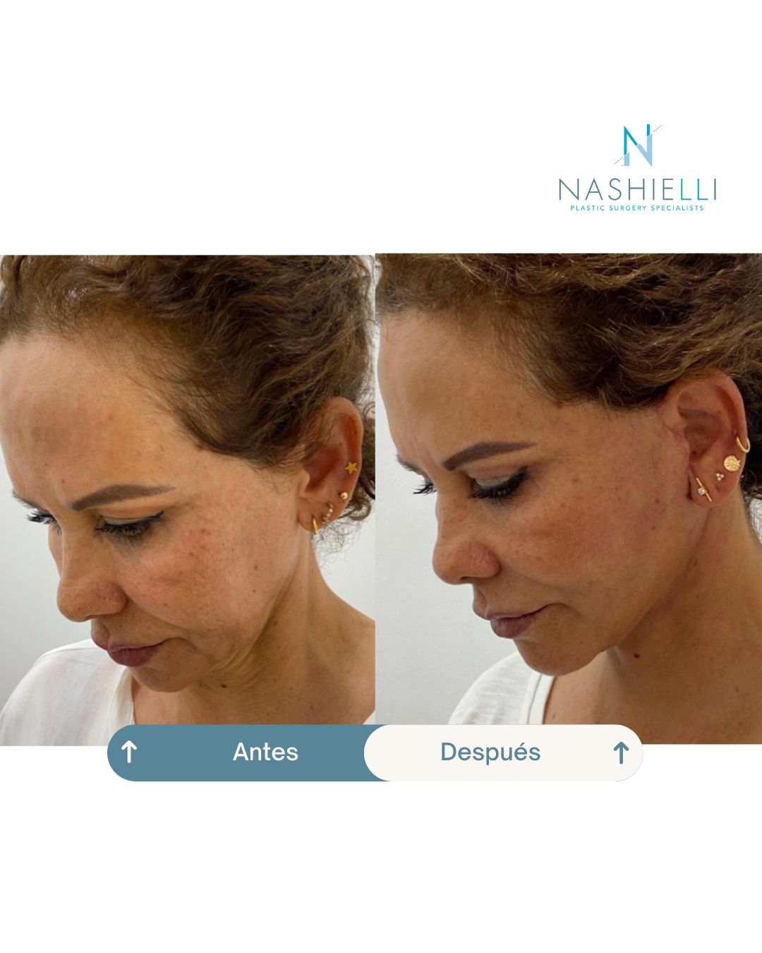 Nashielli Torres Espinosa Chiu-26