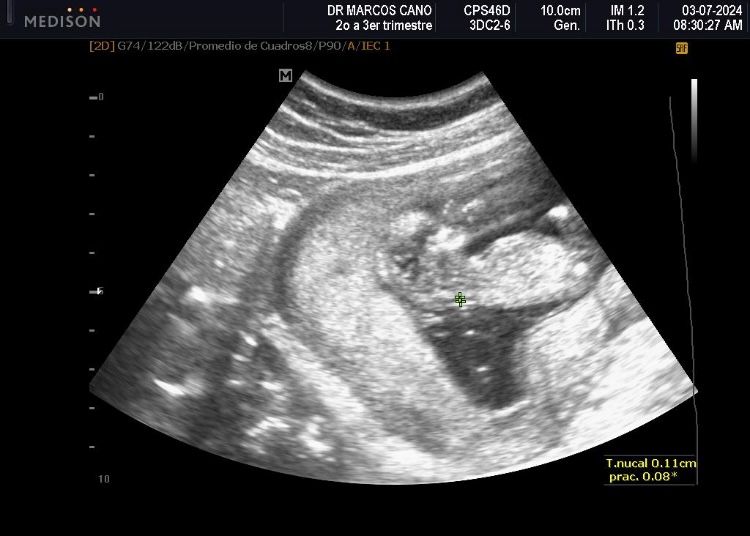 Marcos Javier Cano Luna-6