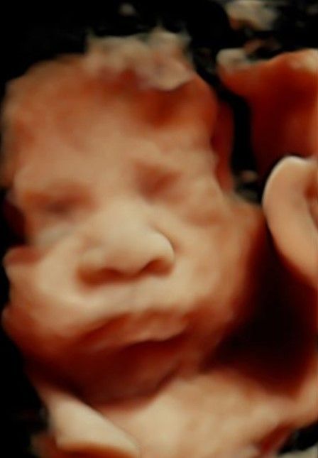 Irlanda Ayala Díaz-1