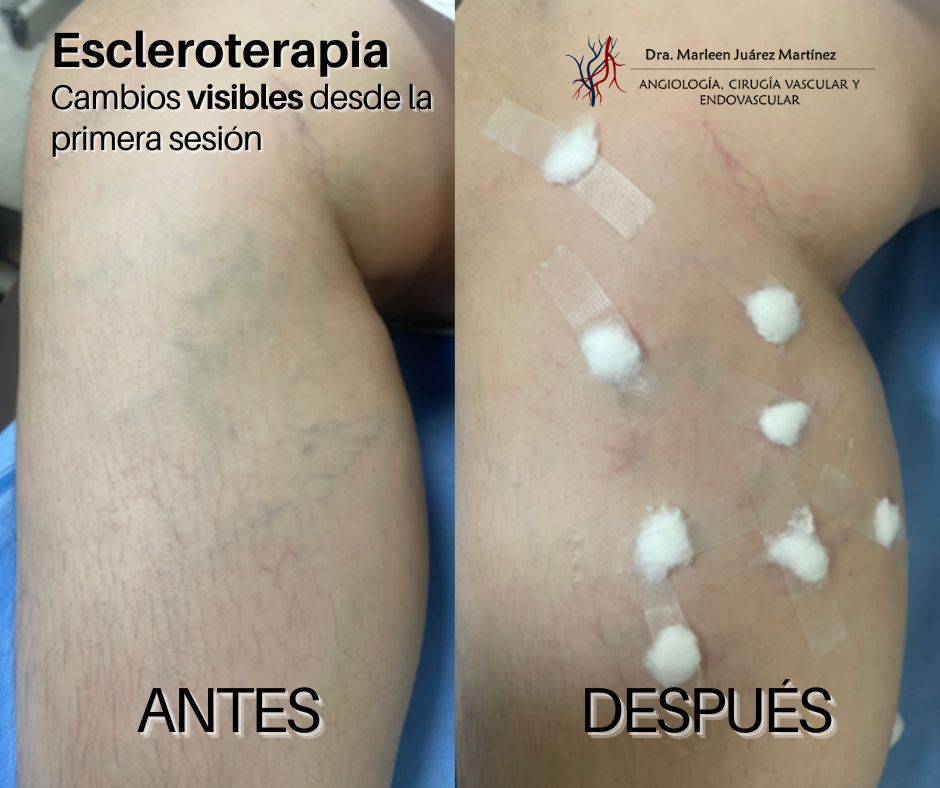 Marleen Juárez Martínez-0