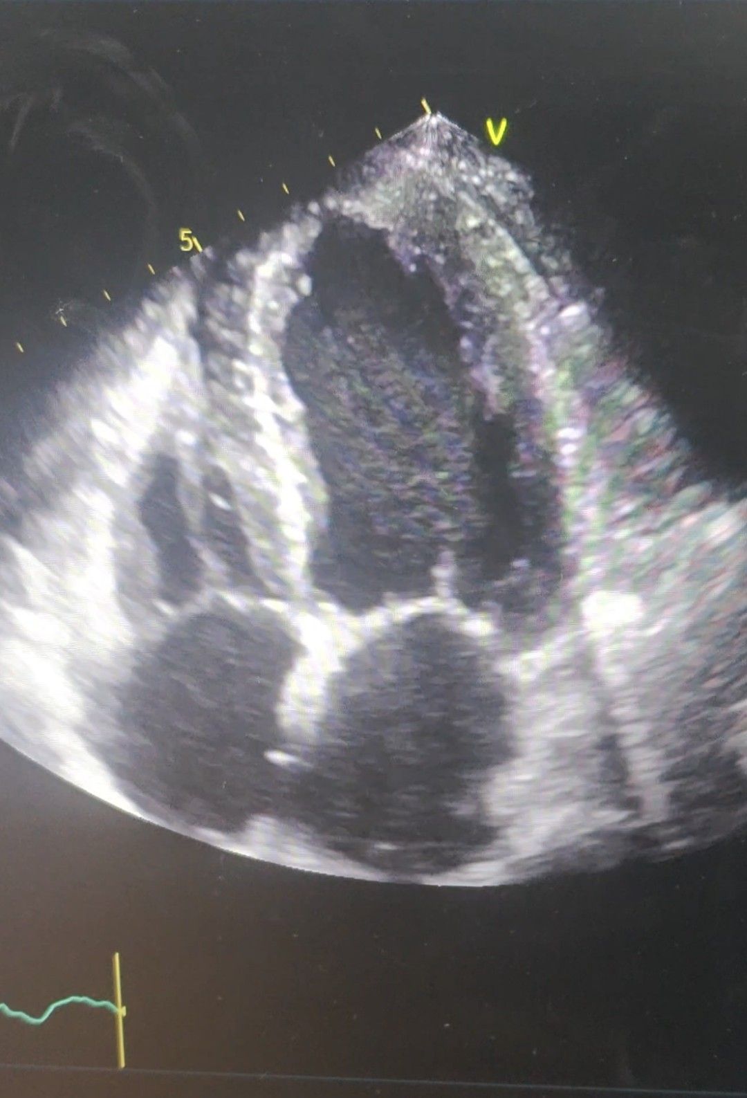 Luis Erik Olivares Sánchez-3