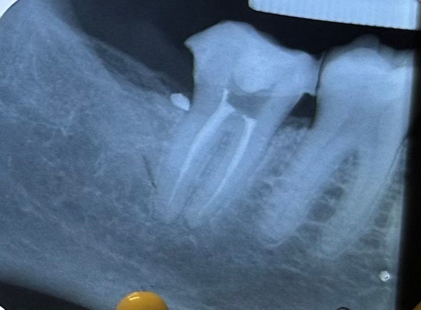 Fernanda Pérez Murrieta-5