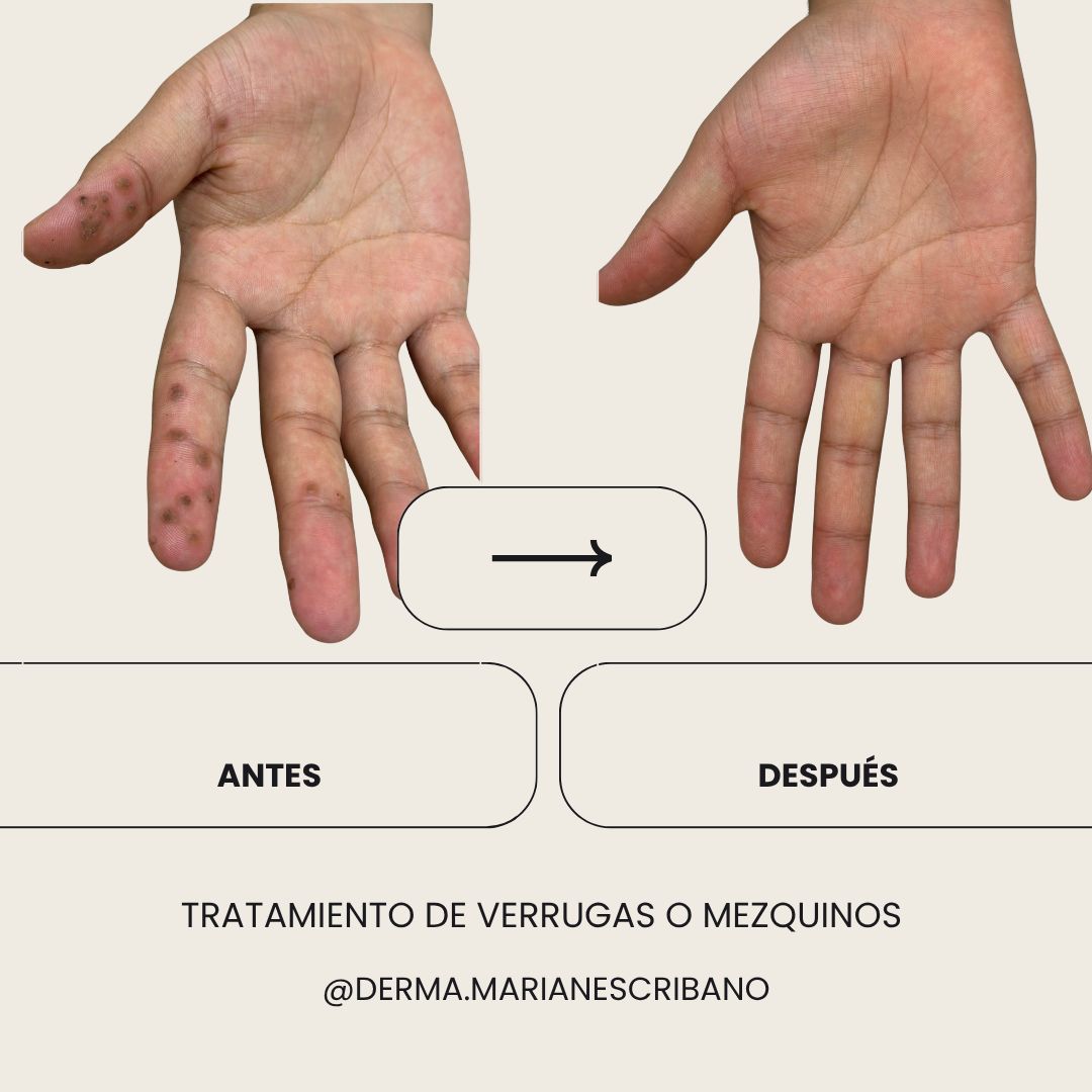 Marian Escribano Ponce-4