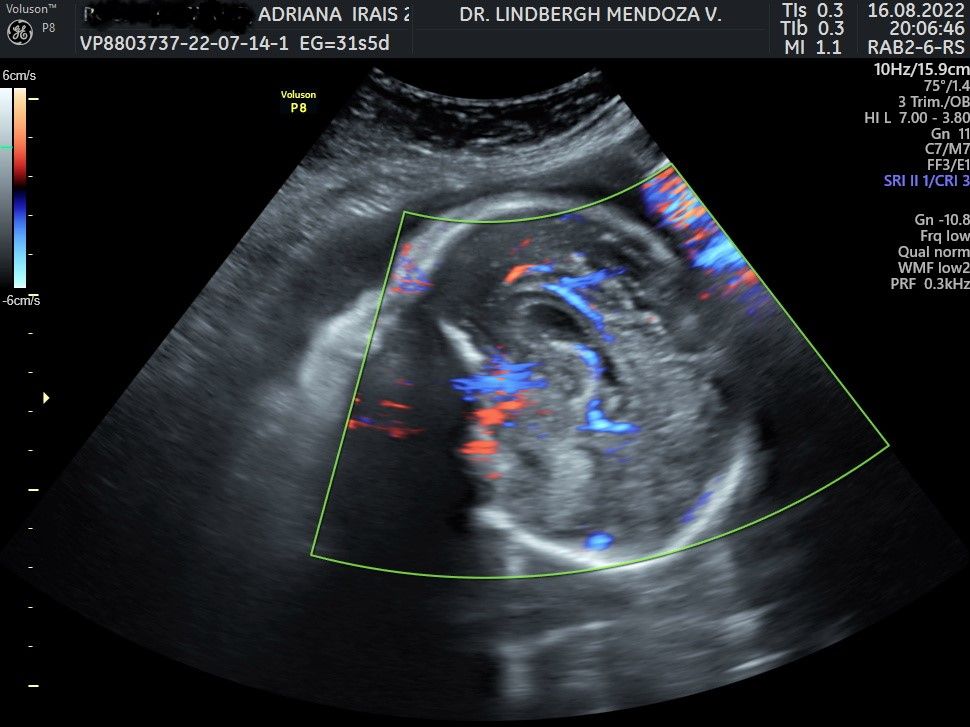 Lindbergh De Jesús Mendoza Villalobos-0