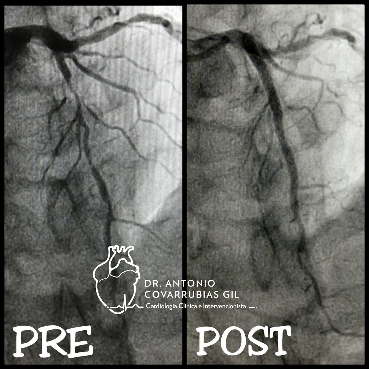 Antonio Covarrubias Gil-31