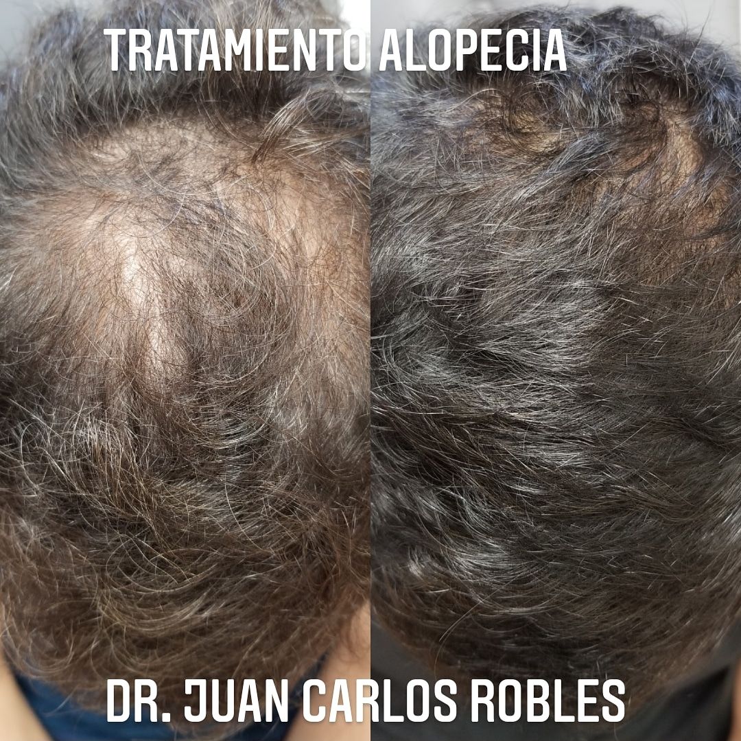 Juan Carlos Robles Méndez-7