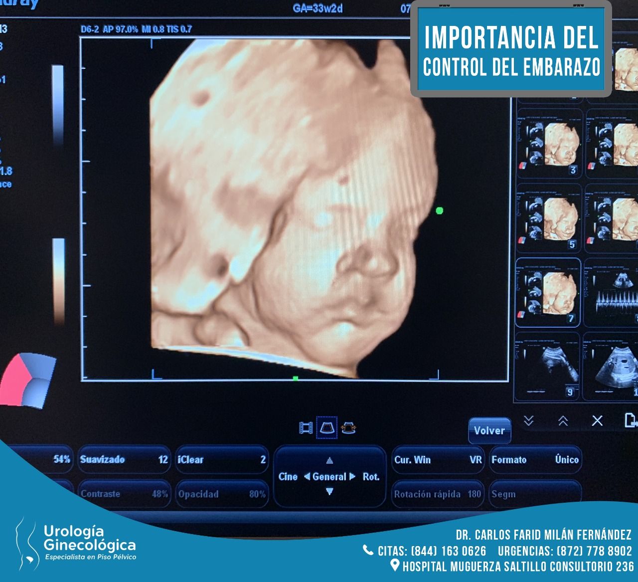 Carlos Farid Milán Fernández-0