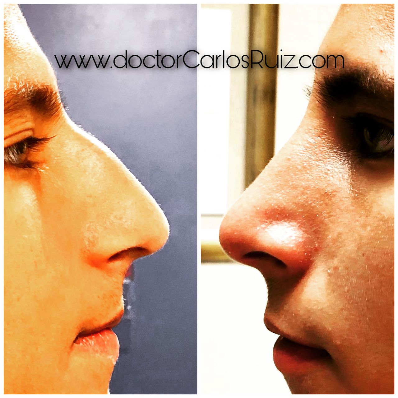 Carlos Alberto Ruiz Zepeda-43