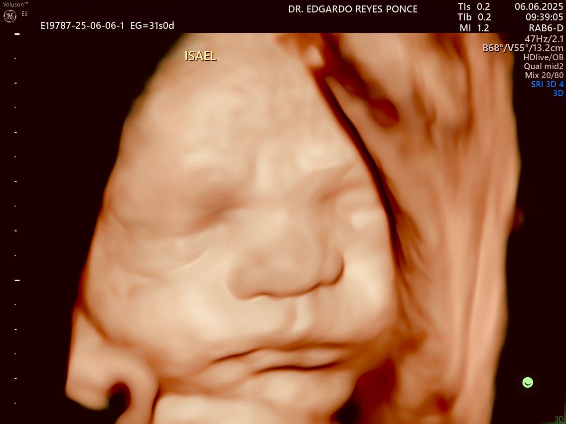 Edgardo Reyes Ponce-0