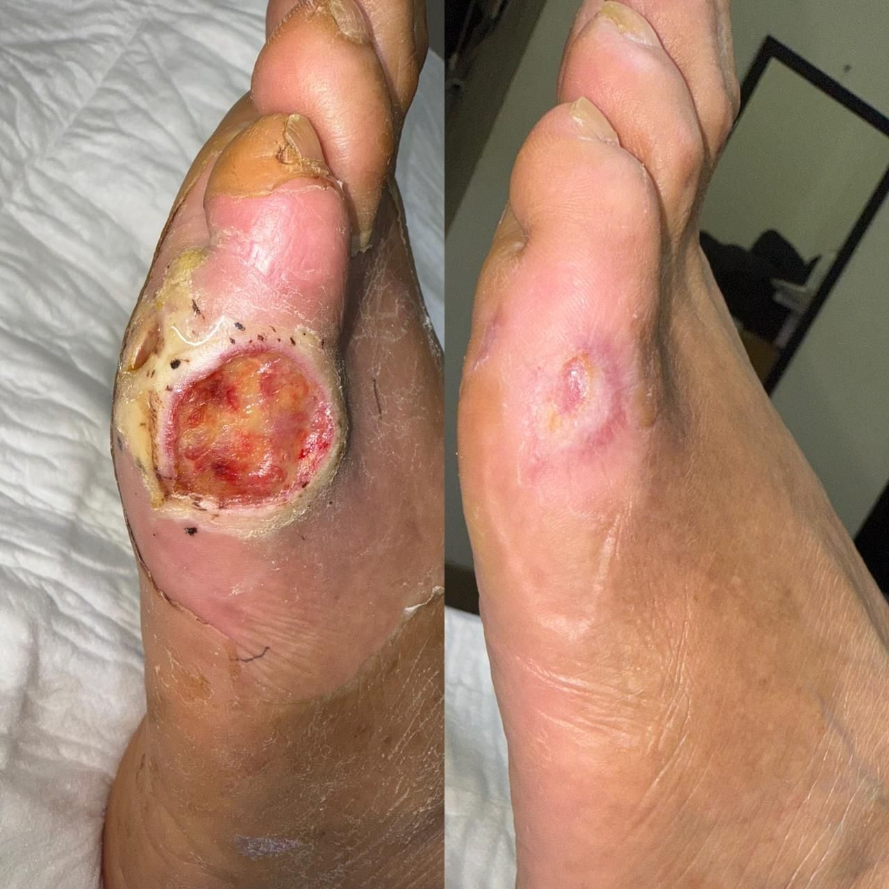 Jhonatan López González-9