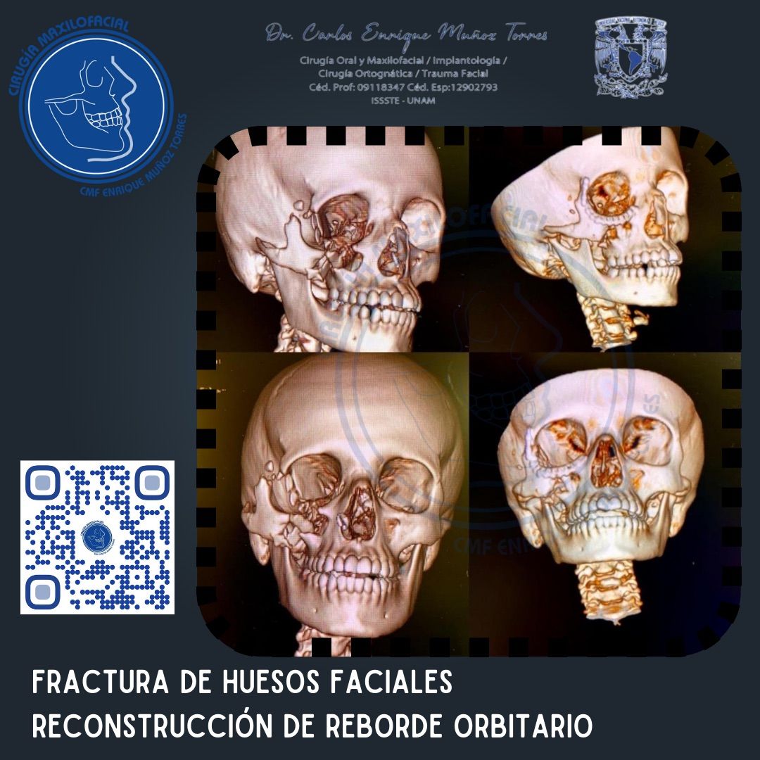 Carlos Enrique Muñoz Torres-10