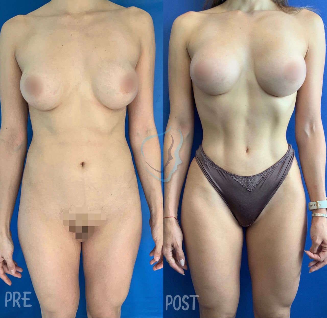 Giuseppe Tanzillo-22