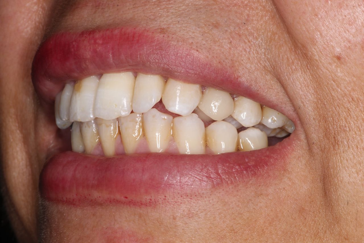 Sergio Torres Rivera-13