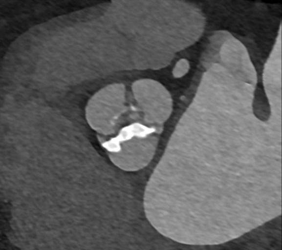 Miguel Franco Estrada-5