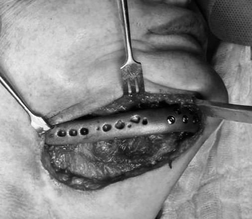 Rodolfo R. Subero Testani-12