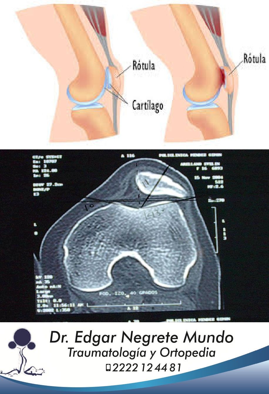 Edgar Negrete Mundo-0