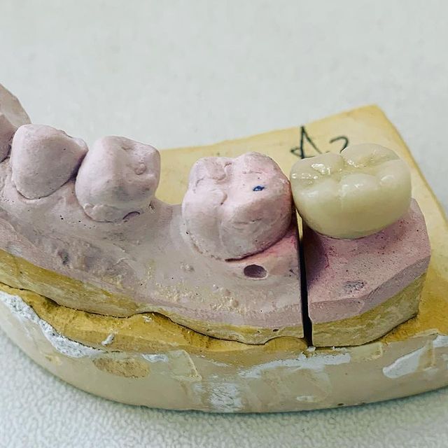 Alejandro Angelo López Díaz-13